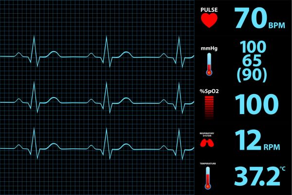 Screen showing graph of heart rate and various other medical data.