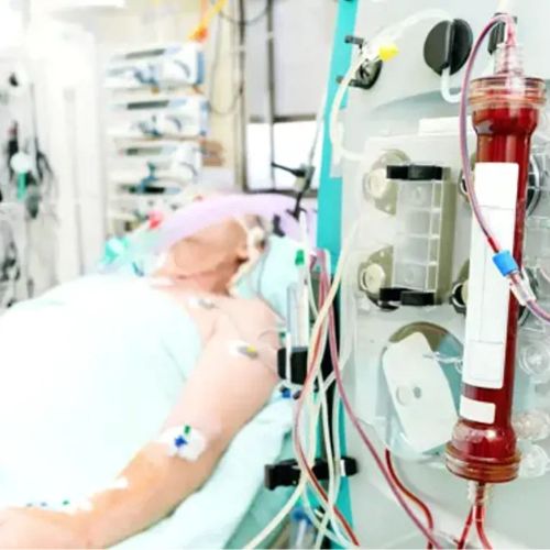 Patient in intensive care connected to medical equipment