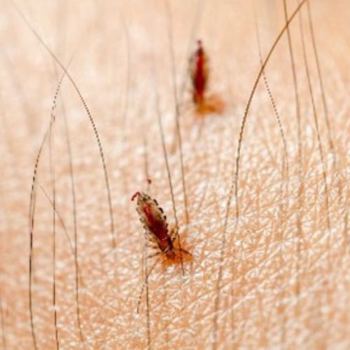 lice on skin
