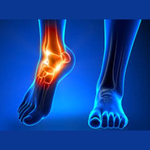 graphic of a human foot with a different colour on the ankle joint, indicating pain