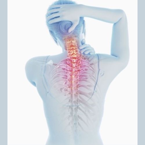 graphic of a human back showing the vertebrae, different colour on the vertebrae indicates pain