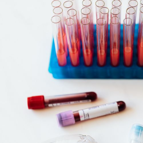 2 vials of blood next to test tubes of solutions made with blood samples